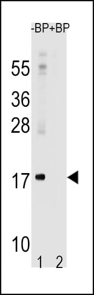 Polyclonal Rabbit anti-Human MAP1LC3A / LC3A Antibody (aa1-30, IHC, IF, WB)
