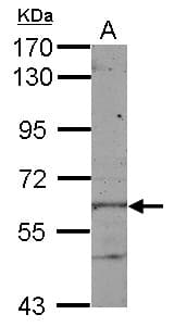 IHC-plus™ Polyclonal Rabbit anti-Human KLHL28 / BTBD5 Antibody (IHC, WB)