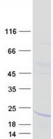 Human IL21 Protein (Recombinant Myc-DDK (Flag))