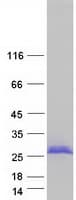 Human NCALD / Neurocalcin Delta Protein (Recombinant Myc-DDK (Flag))