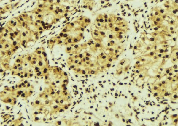 MAGED1 / NRAGE Antibody