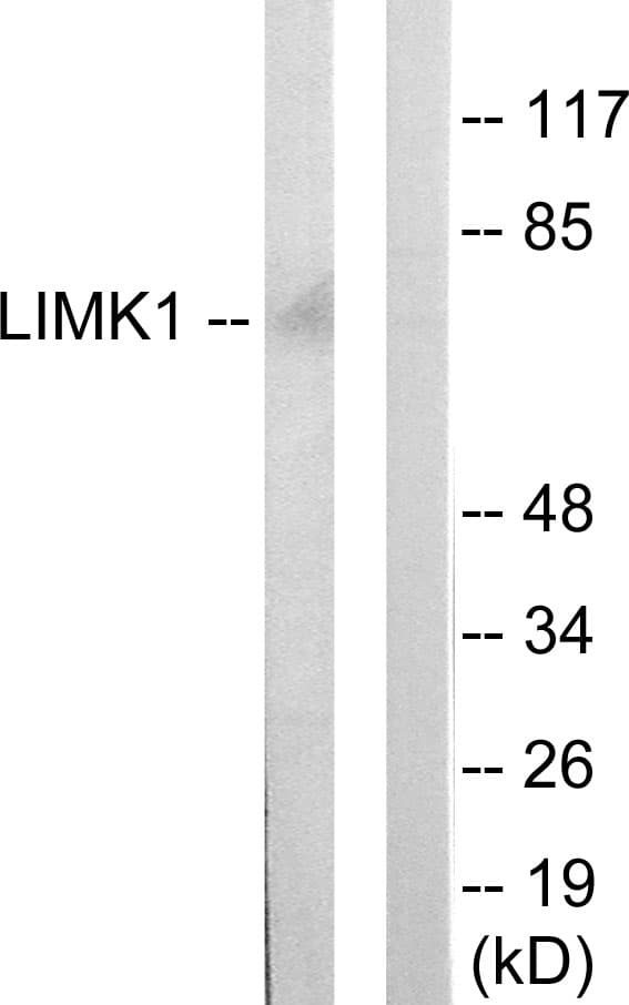 LIMK1 / LIMK Antibody (aa461-510)