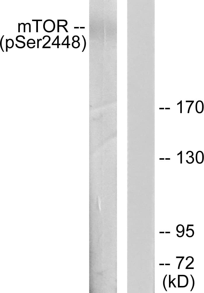 Polyclonal Rabbit anti-Human MTOR Antibody (phospho-Ser2448, IHC, WB)