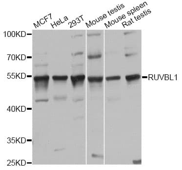 TIP49 / RUVBL1 Antibody