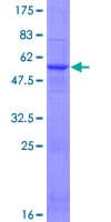 Human GSTO2 Protein (Recombinant GST)