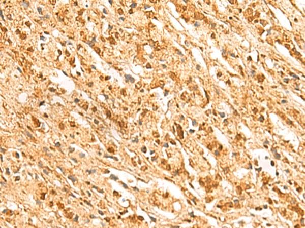 Polyclonal Rabbit anti-Human SSSCA1 / p27 Antibody (IHC, WB)