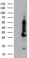 Monoclonal Mouse anti-Human KCNJ3 / GIRK1 Antibody (clone OTI1B1, IF, WB)
