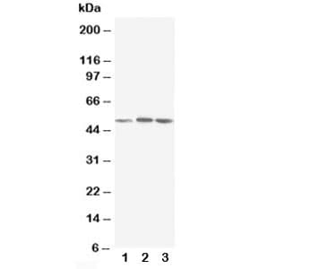 NR1H3 / LXR Alpha Antibody (aa375-398)