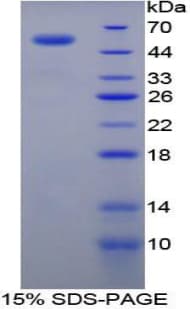 Rat TGM1 / Transglutaminase Protein (Recombinant His-GST)
