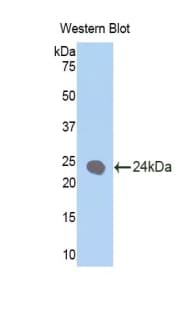 KRT1 / CK1 / Cytokeratin 1 Antibody (aa350-488)