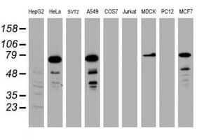 Monoclonal Mouse anti-Human RIPK1 / RIP Antibody (clone OTI2A8, WB)