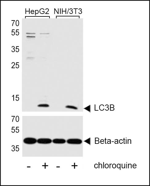 Polyclonal Rabbit anti-Human MAP1LC3B / LC3B Antibody (aa1-30, IHC, IF, WB)