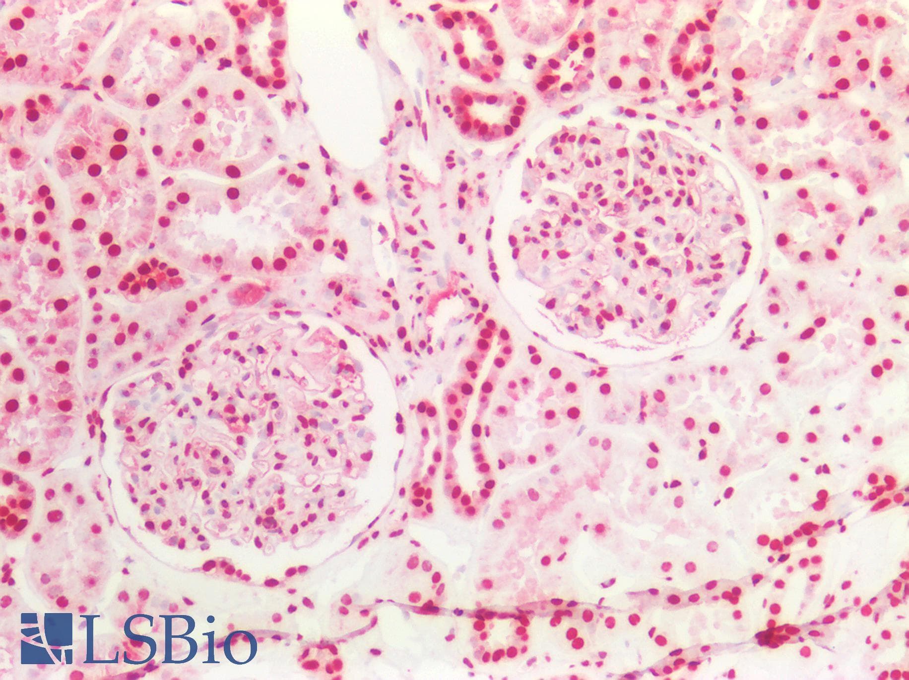 PathPlus™ HNRNPK / hnRNP K Antibody (aa1-50)