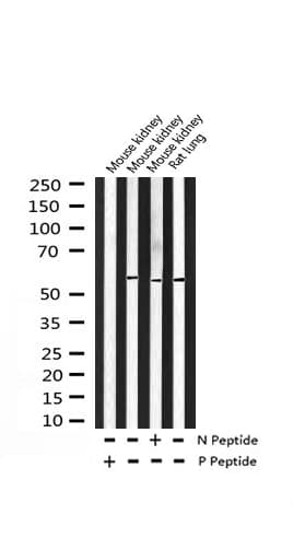 MEF2A / MEF2 Antibody (phospho-Thr319)