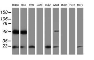 UBE2E3 Antibody (clone OTI3H2, Carrier-free)
