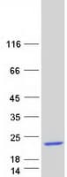 Human DCD / Dermcidin Protein (Recombinant Myc-DDK (Flag))