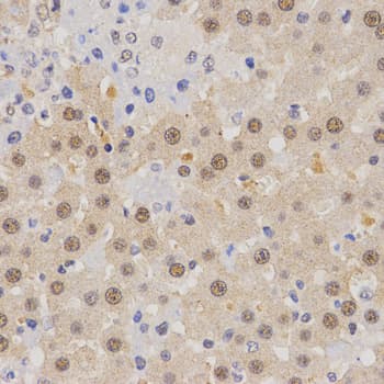 IHC-plus™ Polyclonal Rabbit anti-Human SKIV2L2 Antibody (IHC, WB)