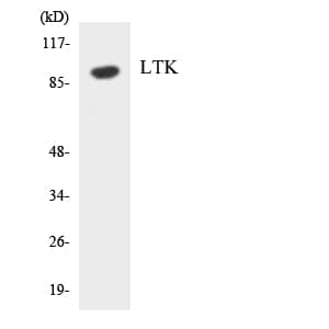IHC-plus™ Polyclonal Rabbit anti-Human LTK Antibody (aa192-241, IHC, WB)