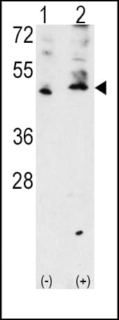 VEGFC Antibody (aa248-277)