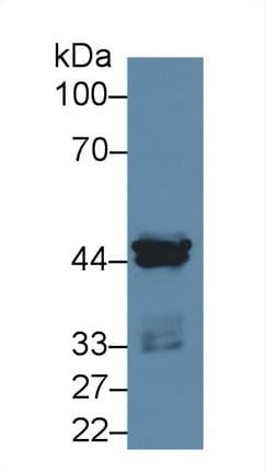 CSNK1A1 / CK1 Alpha Antibody (aa114-324)