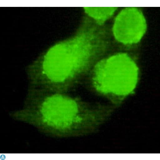 AMACR / P504S Antibody