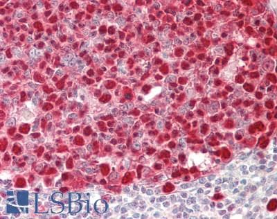 IHC-plus™ PCNA Antibody (clone 1G7)
