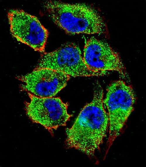 Polyclonal Rabbit anti-Human NKD2 Antibody (aa366-393, IHC, IF, WB)