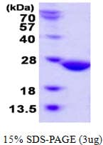 Human ABHD14B Protein (Recombinant His)