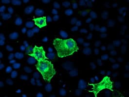 CYP2J2 Antibody (clone OTI3A3)