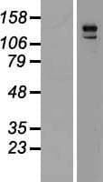 ARHGAP29 / PARG1 Protein (Over-Expression Lysate Myc-DDK (Flag))