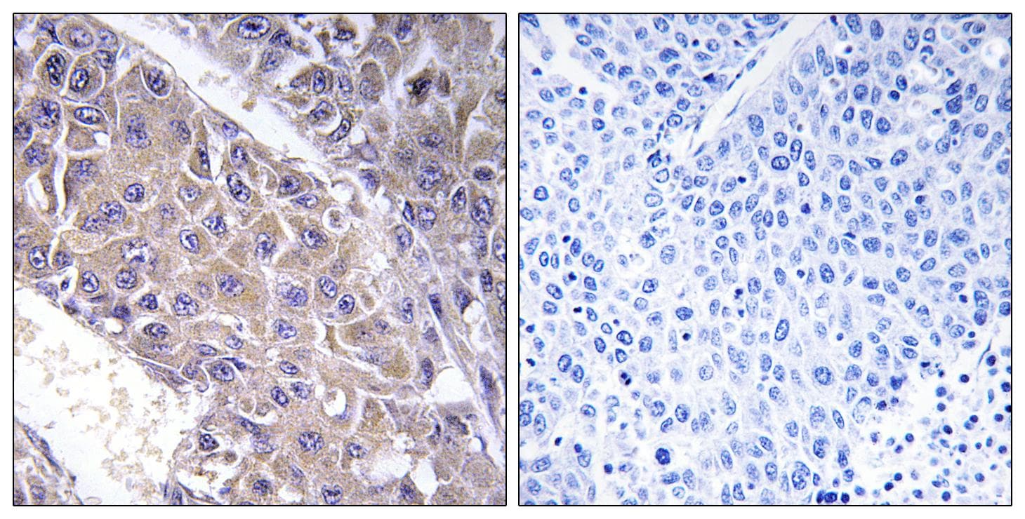 B4GALT3 Antibody