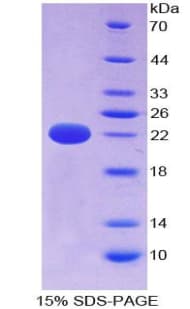 Human CYLD Protein (Recombinant His-T7)