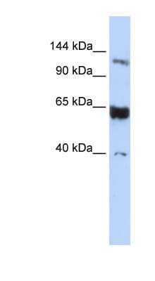 SCP1 / SYCP1 Antibody (aa72-121)