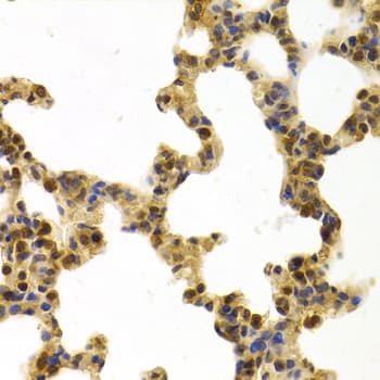 Polyclonal Rabbit anti-Human ERCC1 Antibody (IHC, IF, WB)