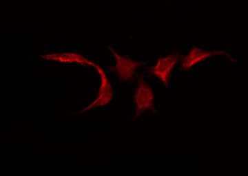 Polyclonal Rabbit anti-Human SIRPG Antibody (IF, WB)