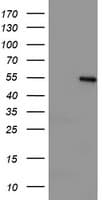 LPL / Lipoprotein Lipase Antibody (clone OTI2G8)