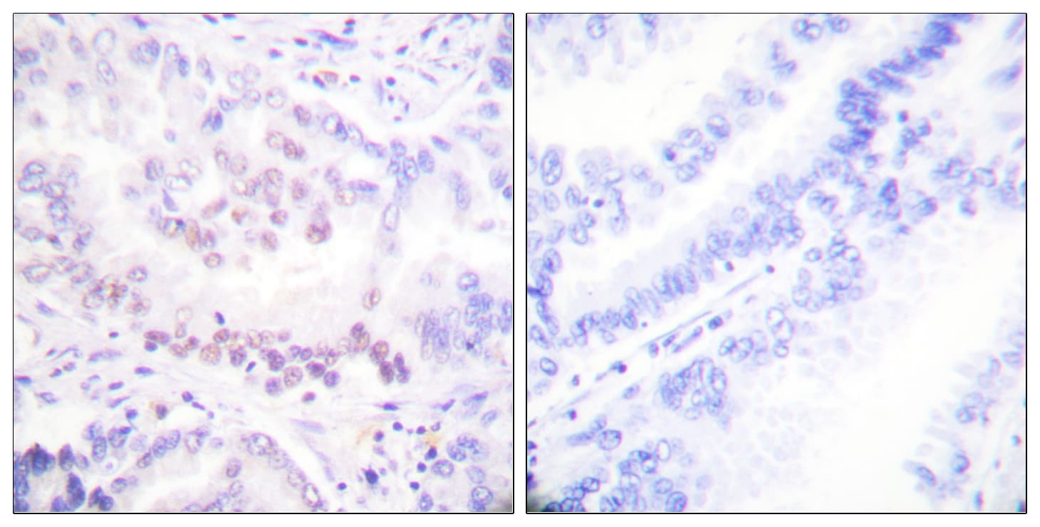 AML1 / RUNX1 Antibody (phospho-Ser303)