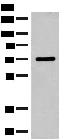 Polyclonal Rabbit anti-Human SLC6A11 / GAT-3 Antibody (WB)