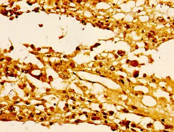 HIST1H1E Antibody