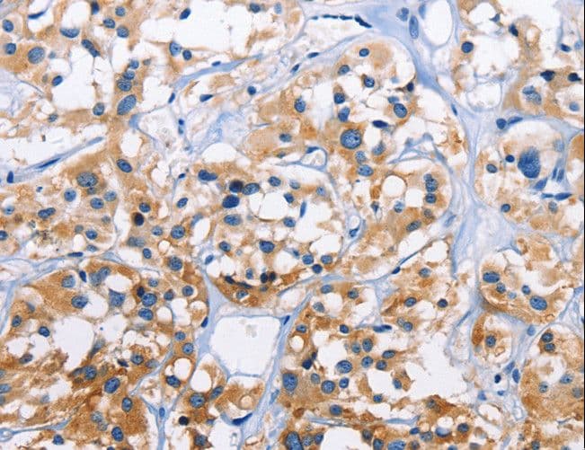CAPZA3 Antibody