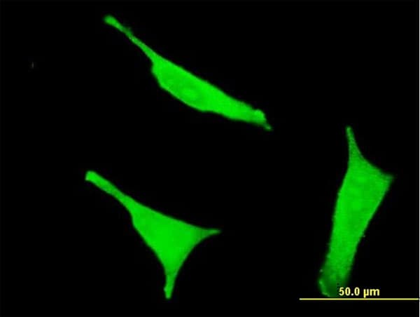 CD38 Antibody (clone 4G3)