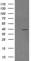 MAP2K3 / MEK3 / MKK3 Antibody (clone OTI5G5)