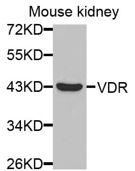 Polyclonal Rabbit anti-Human Vitamin D Receptor / VDR Antibody (IHC, IF, WB)