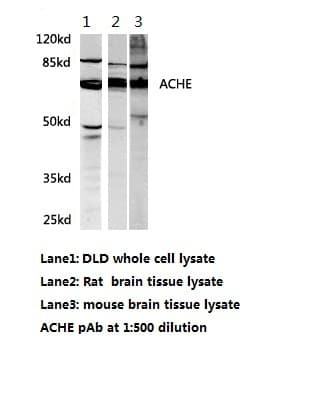 ACHE / Acetylcholinesterase Antibody