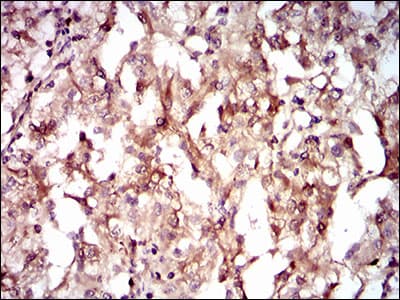 Monoclonal Mouse anti-Human GUCY1A1 / GUCY1A3 Antibody (clone 3G6B2, aa22-214, IHC, IF, WB)