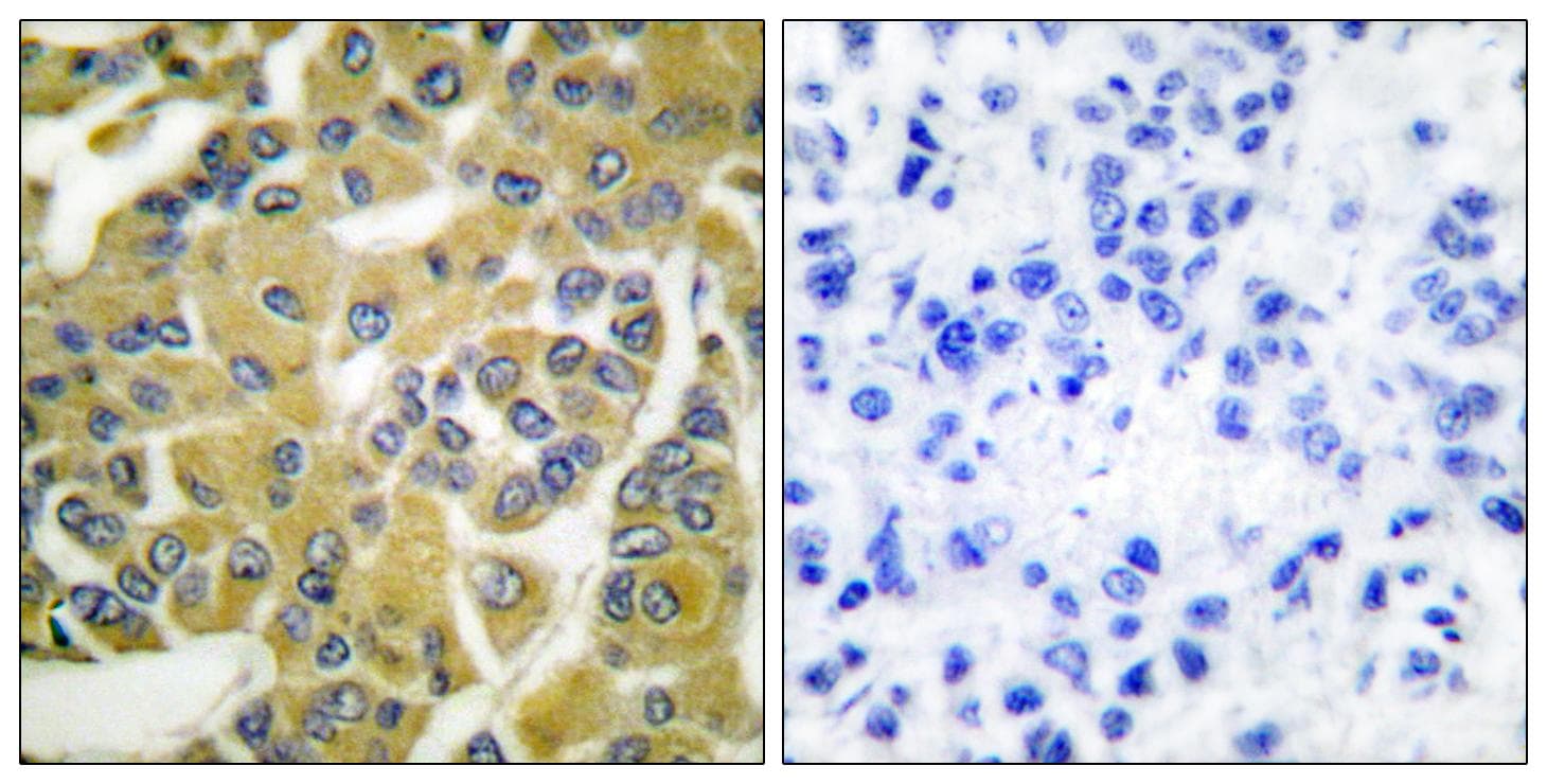 IKBKB / IKK2 / IKK Beta Antibody (phospho-Tyr188)