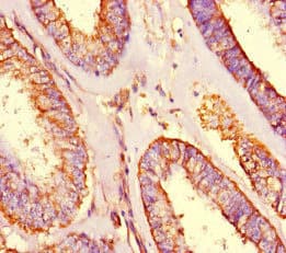 SHROOM3 Antibody