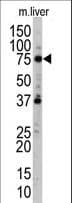 Polyclonal Rabbit anti-Human UVRAG Antibody (aa120-152, IHC, IF, WB)
