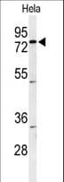 CLPTM1 Antibody (aa198-227)