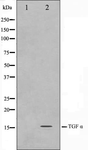 TGFA / TGF Alpha Antibody